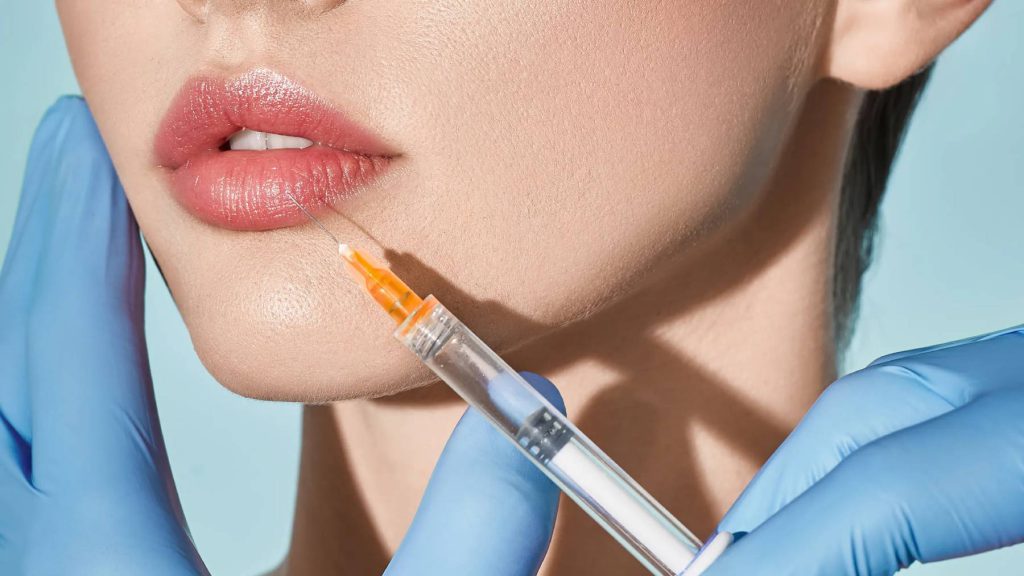 Tiêm filler tạo hình khuôn mặt cho người đi làm