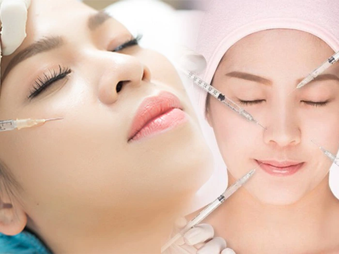 Tiêm filler tạo hình khuôn mặt cho người đi làm