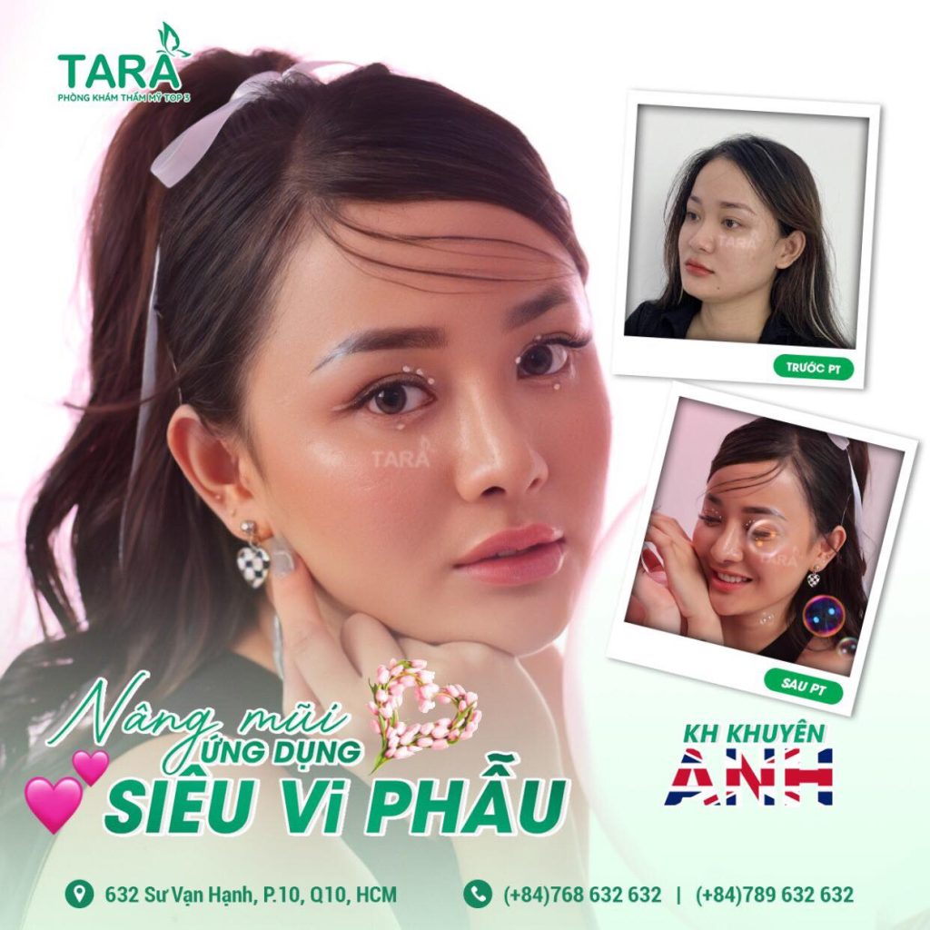 Vì sao nên đến TARA để nâng mũi siêu vi phẫu?